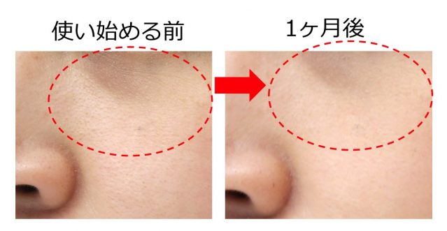 ポーラ BA 効果