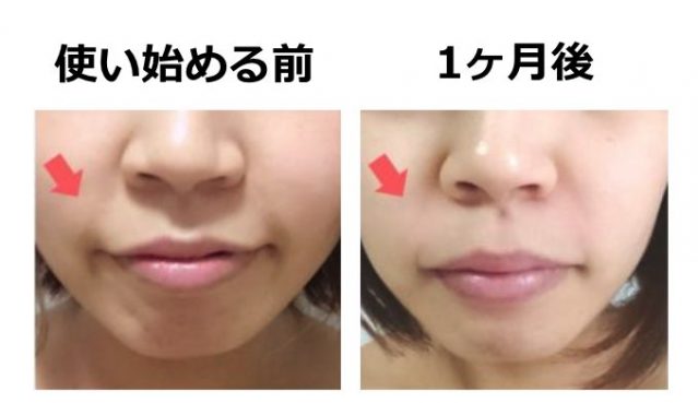 ポーラ BA 効果